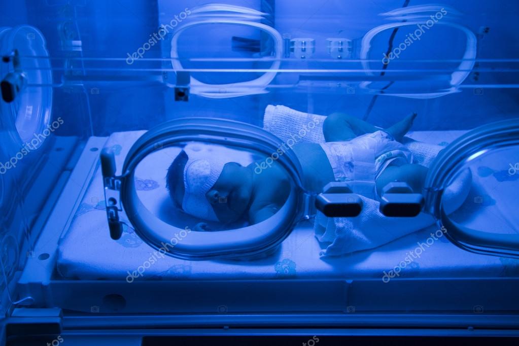 Newborn Baby having UVB phototherapy treatment for jaundice — Stock