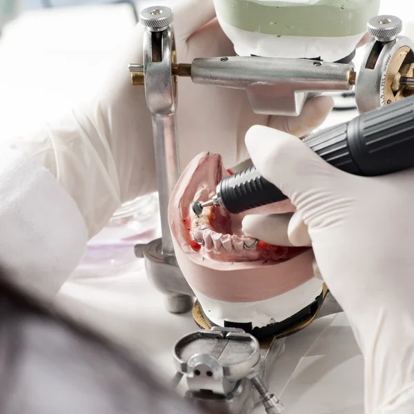 Dental technician working with articulator