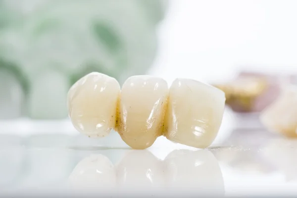 Macro of prosthetic teeth on a white background