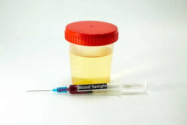 Blood to be analyzed and a specimen of urine