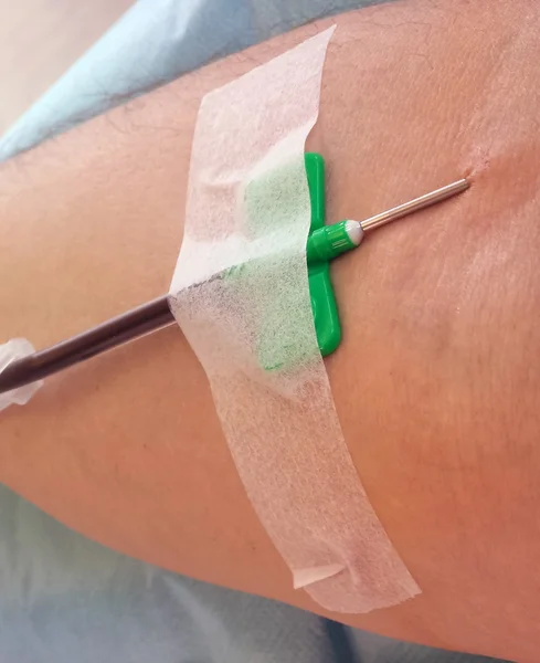 Blood donor during the transfusion at the hospital with the need
