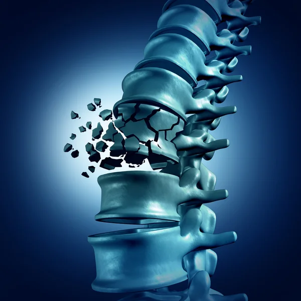 Spinal Fracture medical