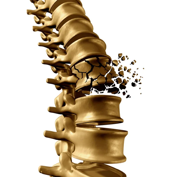 Spine Fracture Concept