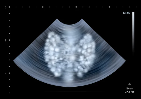 Ultrasound scan of human thyroid gland. Illustration