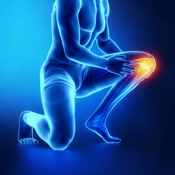 Male knee injured and sprained