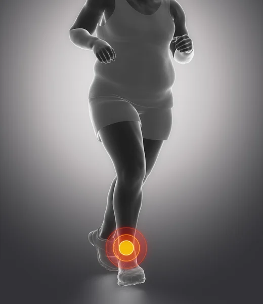 Obesity man running with ankle joint ache