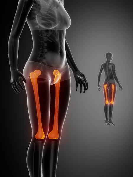 FEMUR x--ray bones scan