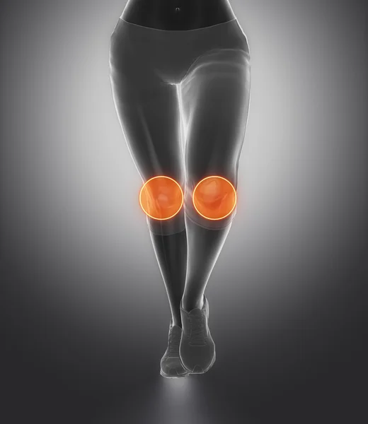 Knee and meniscus in sports injuries