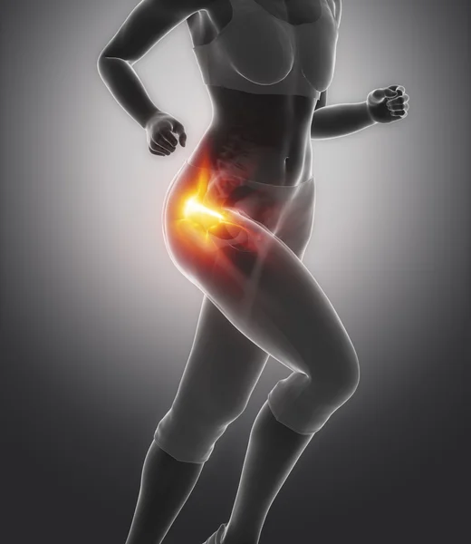 Running woman with  hip injury concept