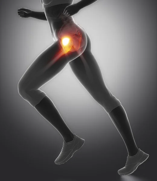 Running woman with hip injury concept