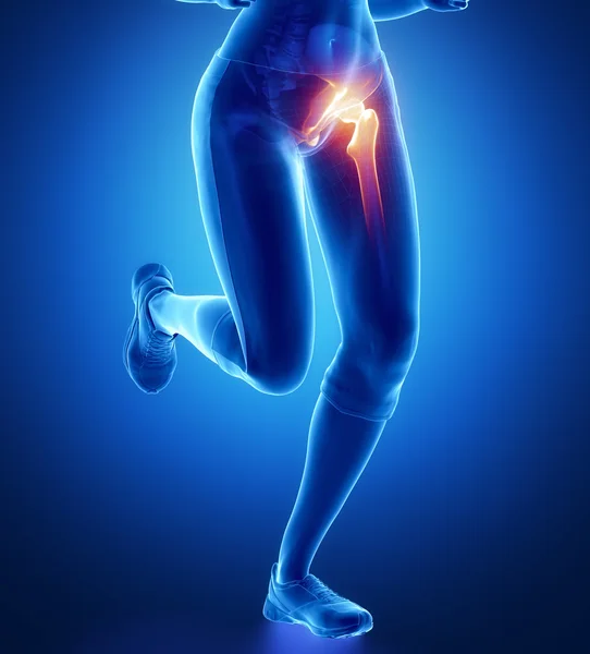 Running woman with pain in hip