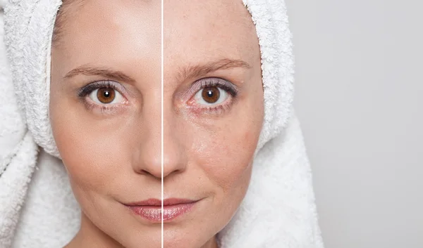 Beauty concept - skin care, anti-aging procedures, rejuvenation,