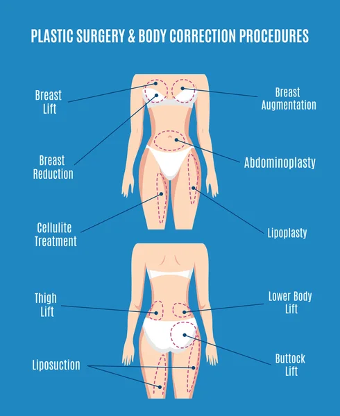 Plastic surgery  body correction vector illustration. Lifting plasty liposuction, cellulite removal and fat lose