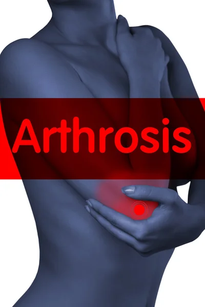 A man holding his elbow. Pain in the elbow joint.Pain. Arthrosis