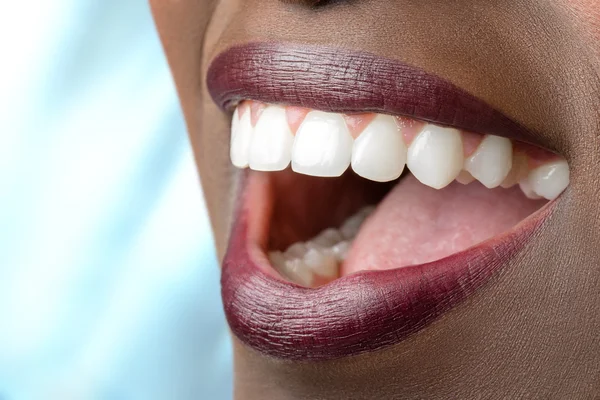 Perfect teeth of african woman.