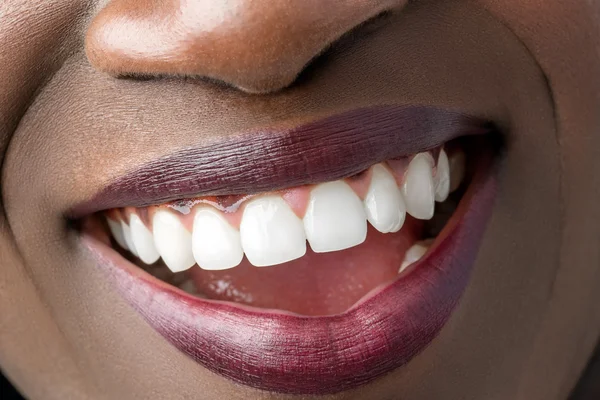 Smiling mouth of african girl.