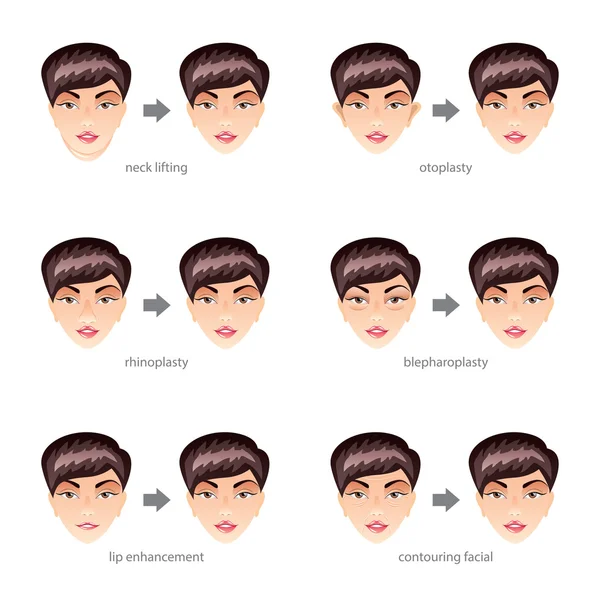 Plastic surgery on face vector set