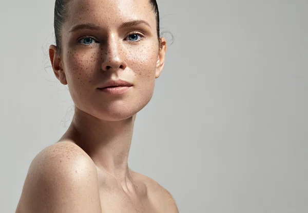 Woman with freckles on skin