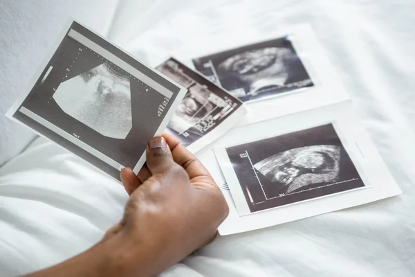 Feminine hands holding ultrasound pictures
