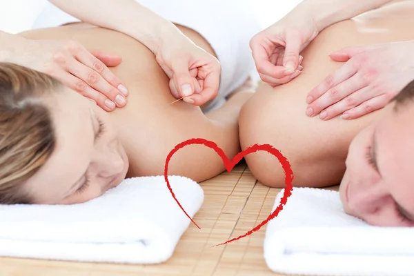 Couple in an acupuncture therapy