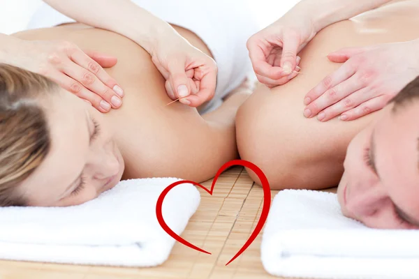 Relaxed couple in an acupuncture therapy