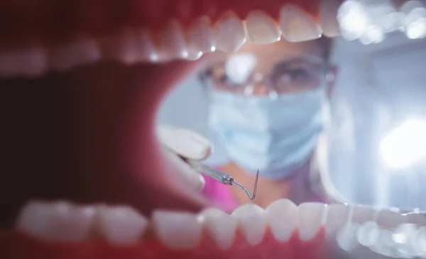 Close up of a mouth open with the dentist behind
