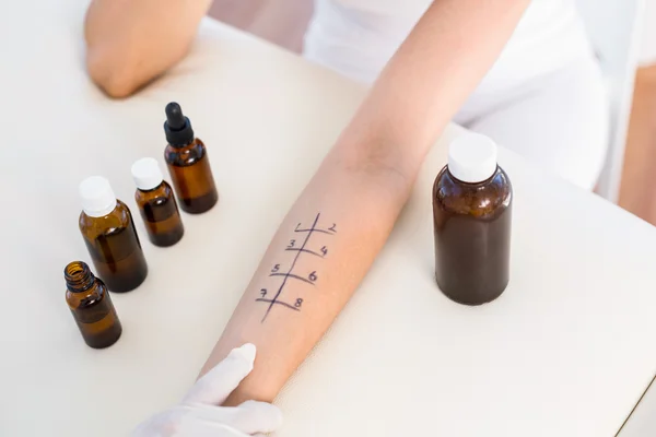 Doctor doing skin prick test at patient