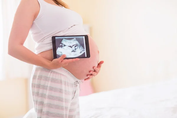 Pregnant woman showing ultrasound scans