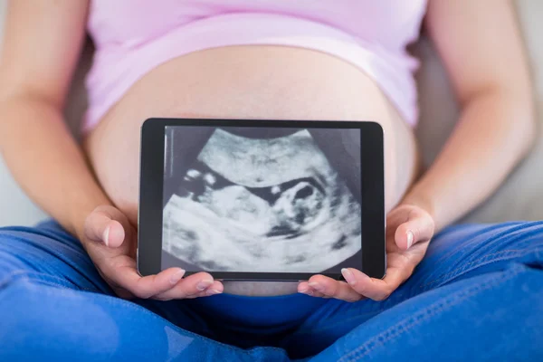 Pregnant woman showing ultrasound scans