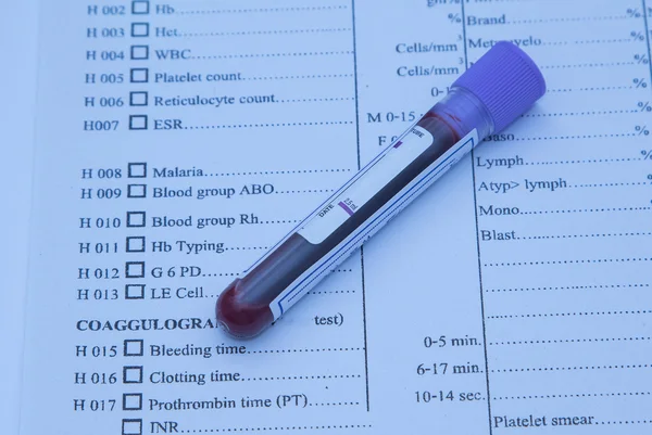 A bottle of blood sample on medical report