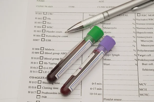 bottle of blood sample on medical report