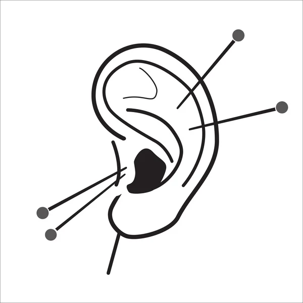 Human Ear acupuncture with needles vector illustration. Medical procedure illustration. Chinese Traditional, Alternative Medicine, Natural Healing and Recreation vector icon.