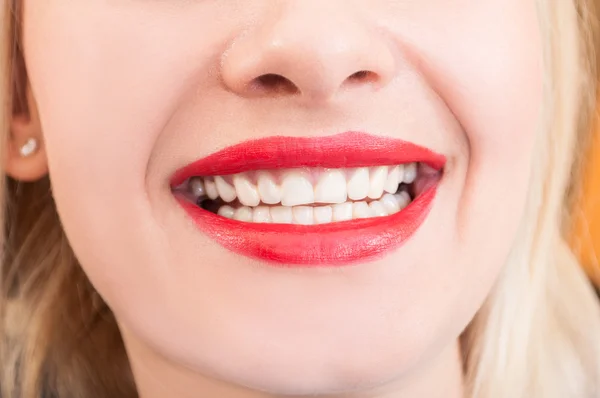 Beautiful woman smile, teeth or denture