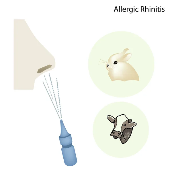 The Allergic Rhinitis Patient with Nose Spray