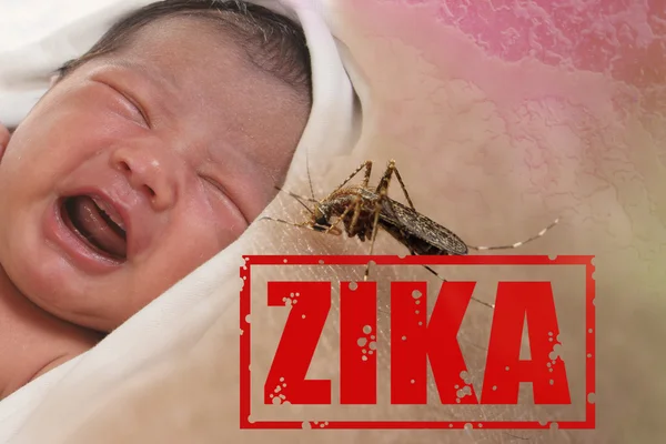 Zika Virus Epidemy