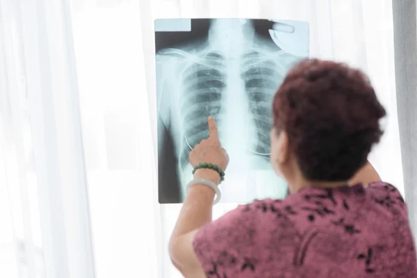 Senior woman looking at x-ray