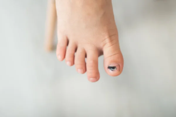 Blue and black toe nail
