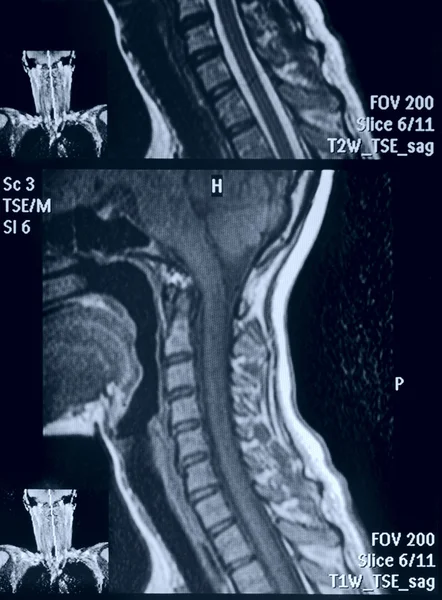 Head and neck MRI scan, anonymized