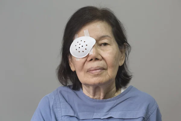 Eye shield covering after cataract surgery.