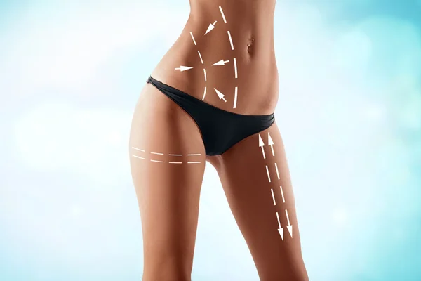 Fit female body with the drawing arrows. Plastic surgery, health