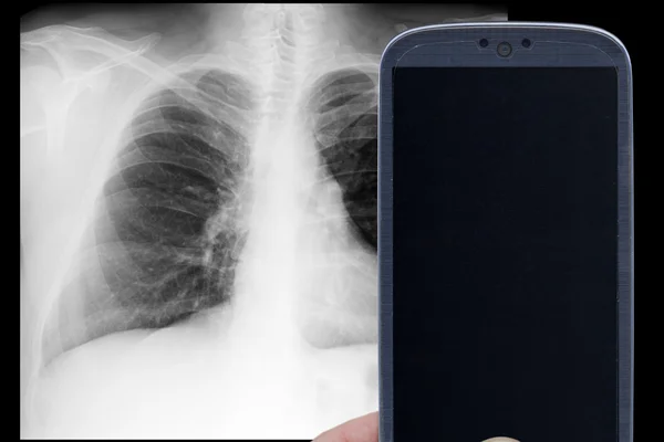 Smartphone x-ray