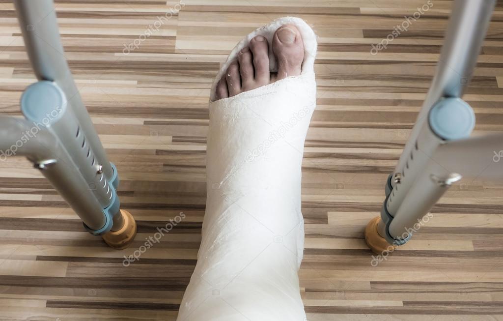 Broken ankle blue image
