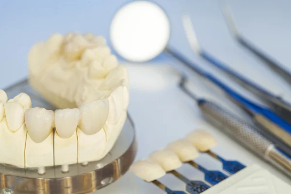 Metal free ceramic dental crowns