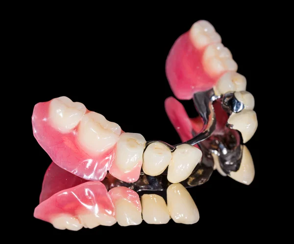 Removable dental prosthesis
