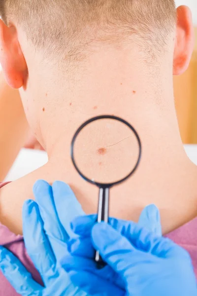 Dermatologist examines a birthmark of a male patient