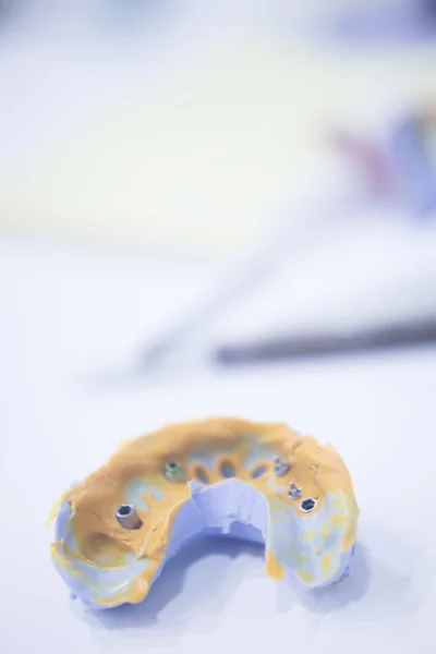 Dental mold dental impression plate