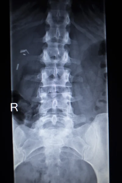 X-ray orthopedics Traumatology scan back pain spine injury