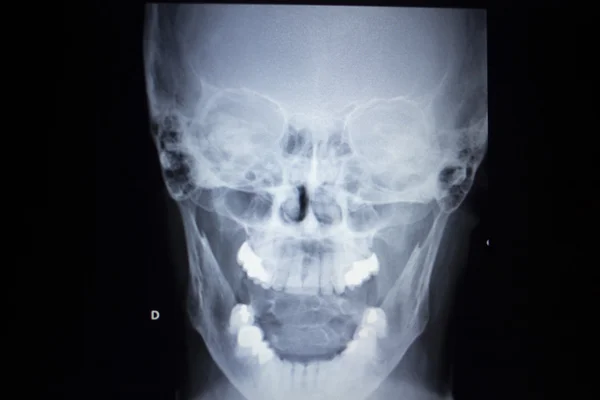 X-ray orthopedics Traumatology scan nose injury breathing