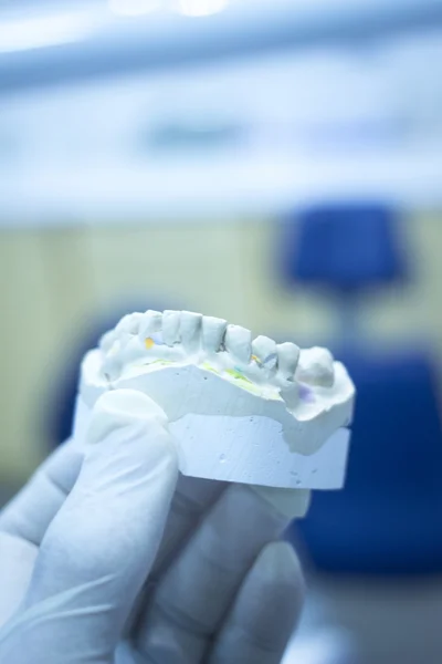 Dental mold dentist clay teeth ceramic plate model cast