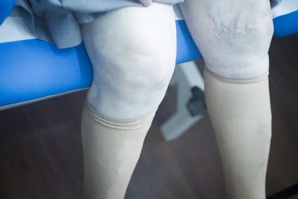 Patient leg in physical therapy physiotherapy